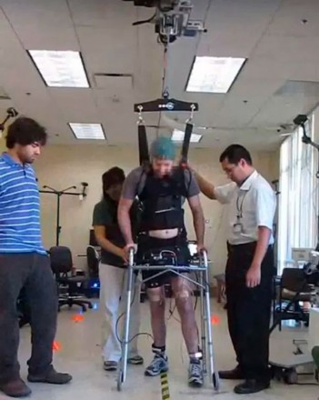 Homem caminha com aparelho ortopédico cercado por três pessoas