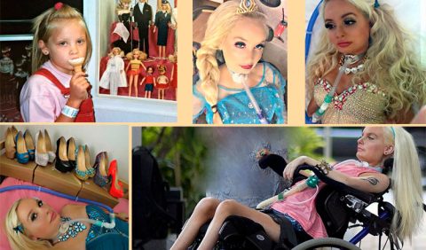 Cinco fotografias dispostas sobre um fundo bege em que apresenta uma garotinha tomando sorvete e quatro outras de uma jovem em cadeira de rodas e tubo respiratório na traquéia, produzida como a boneca barbie