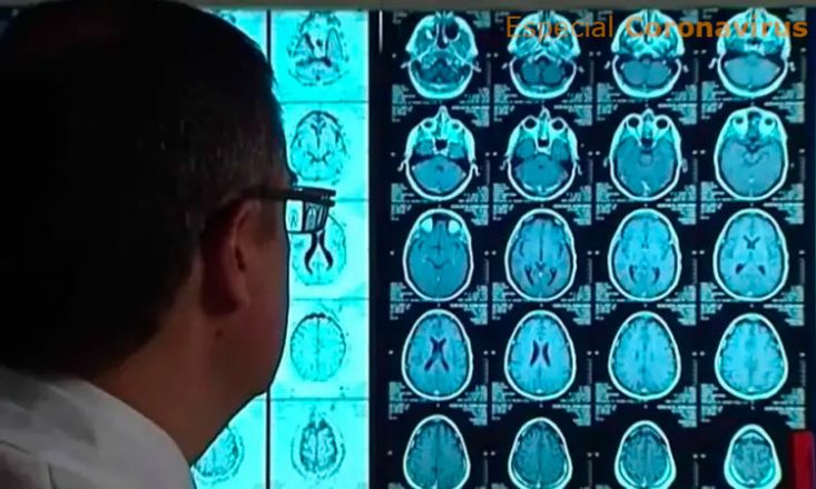 Homem de óculos e roupa branca está de costas para a câmera e olha para a tela de um computador onde estão projetadas imagens de um exame cerebral.